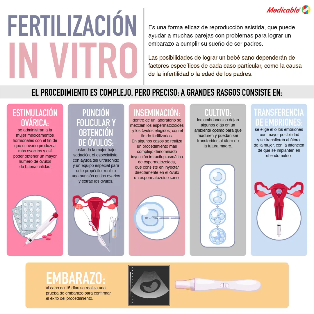 Fertilización invitro