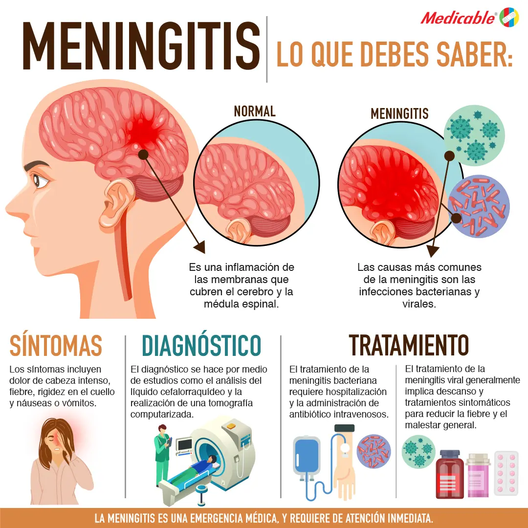 Meningitis lo que debes saber