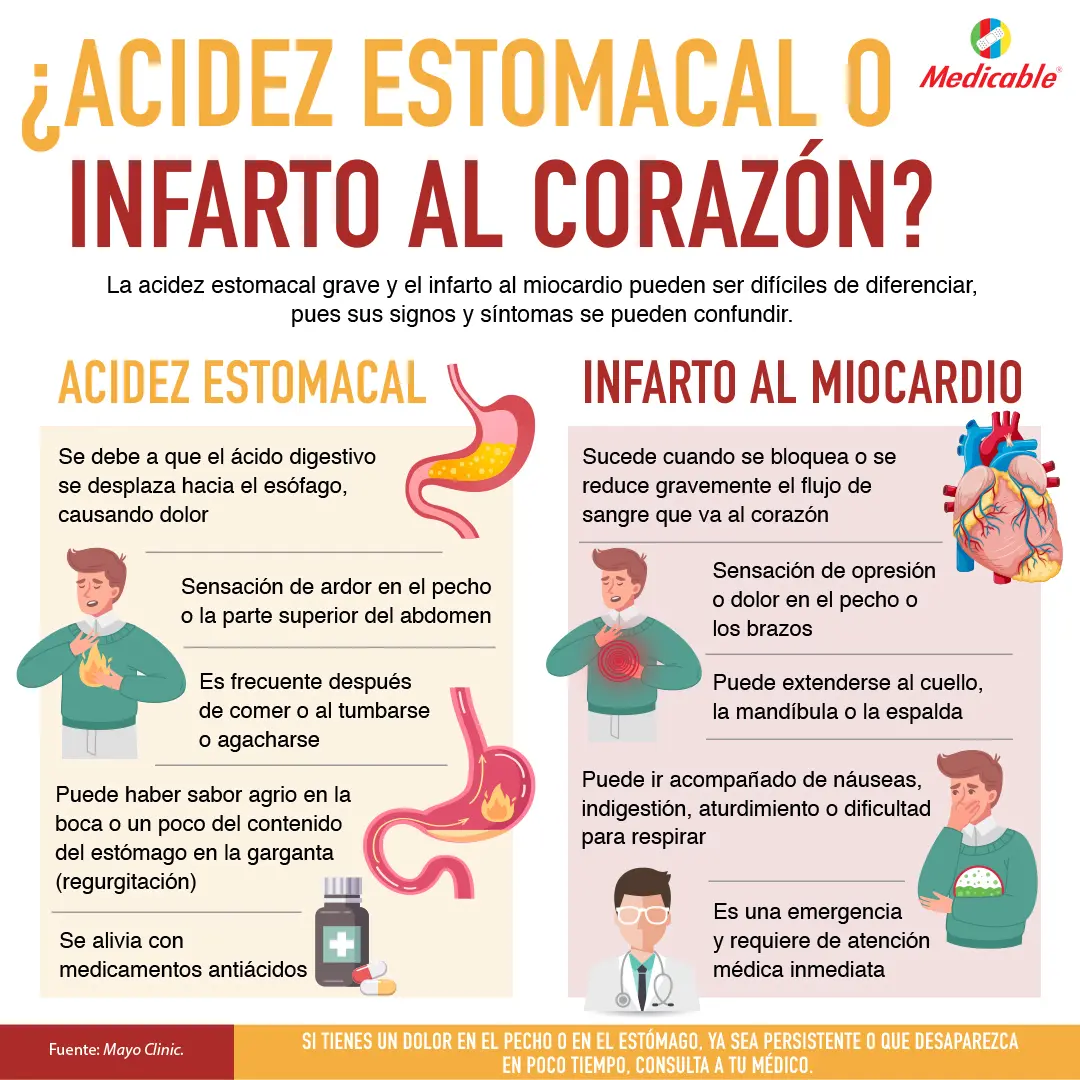 ¿Acidez estomacal o infarto al corazón?