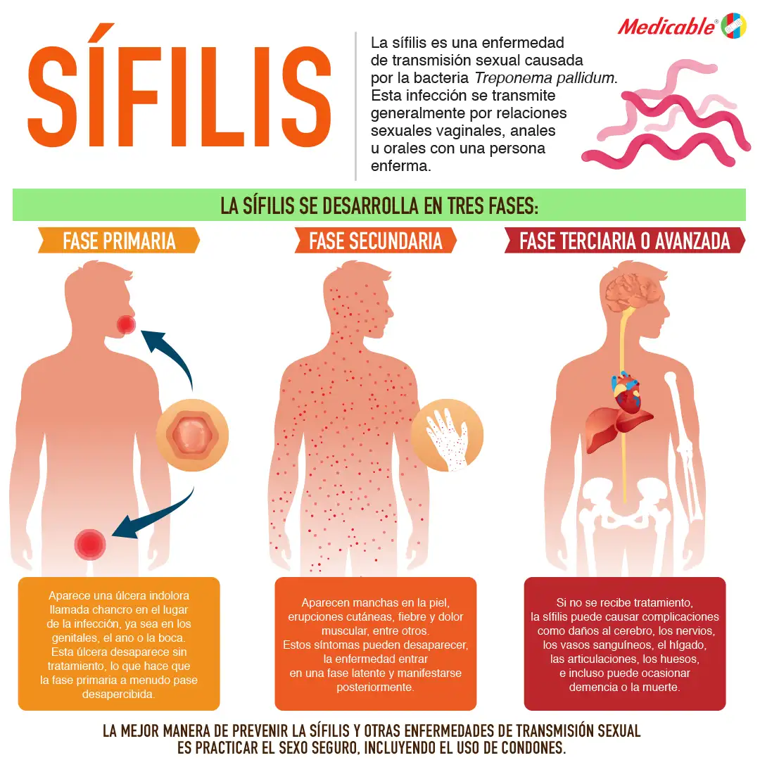 Sífilis