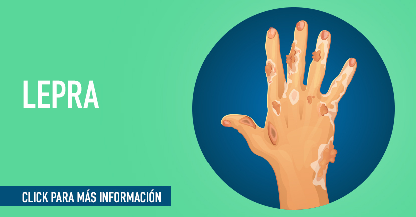 Lepra