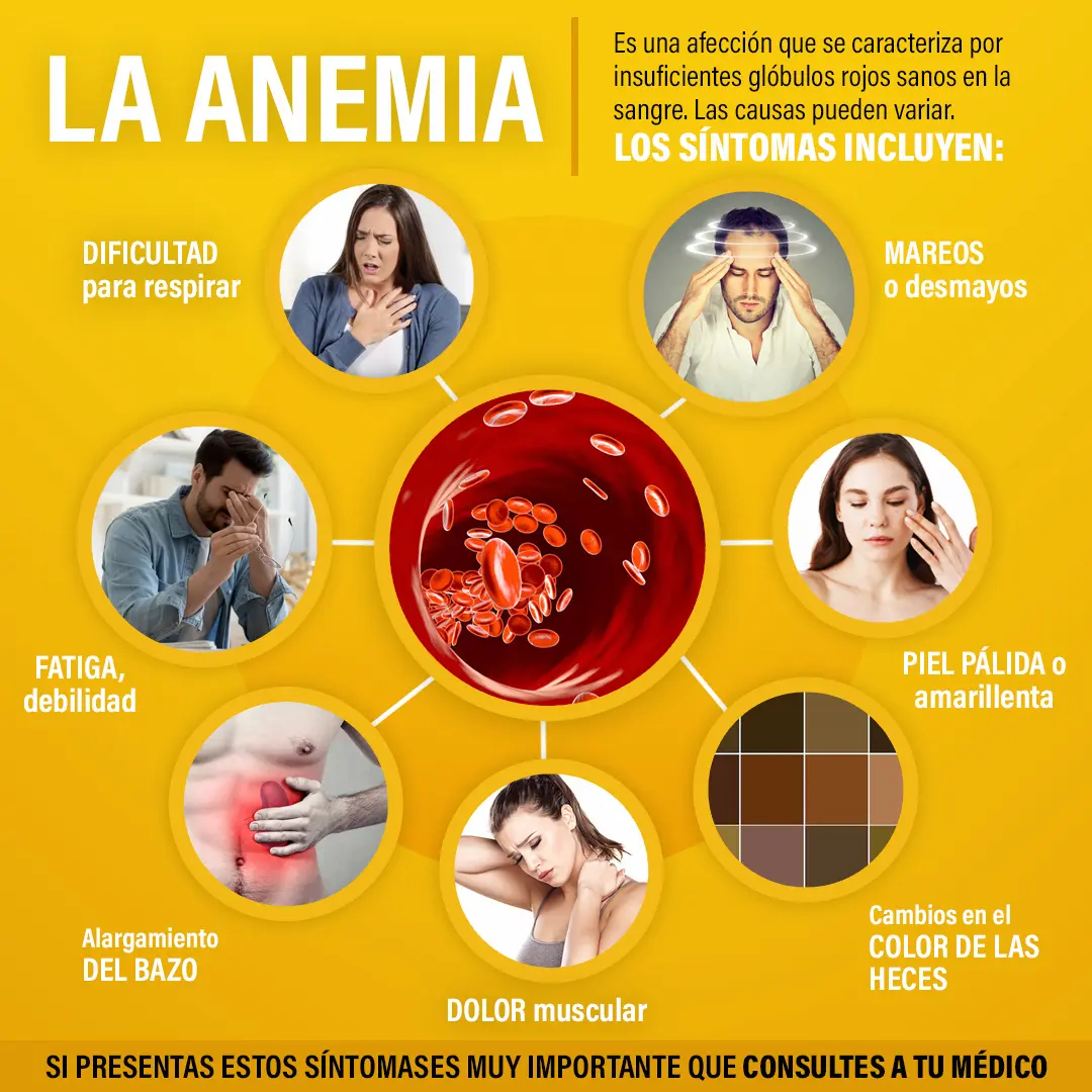 Ese Cansancio Podría ser Anemia