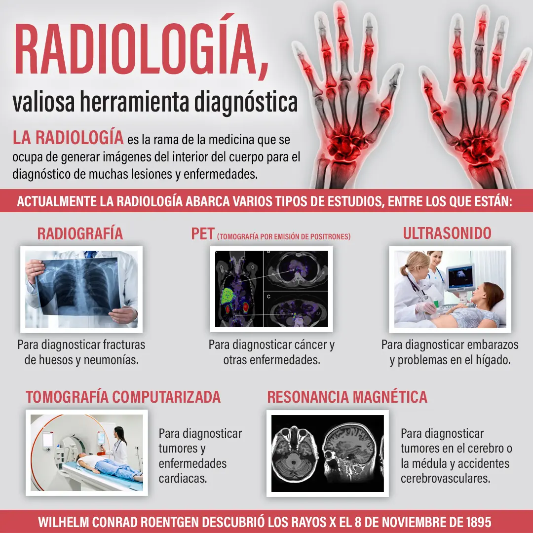 8 de noviembre, Día Mundial de la Radiología