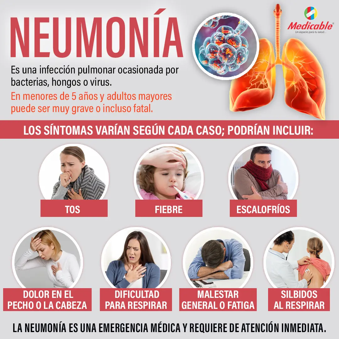 Neumonía 