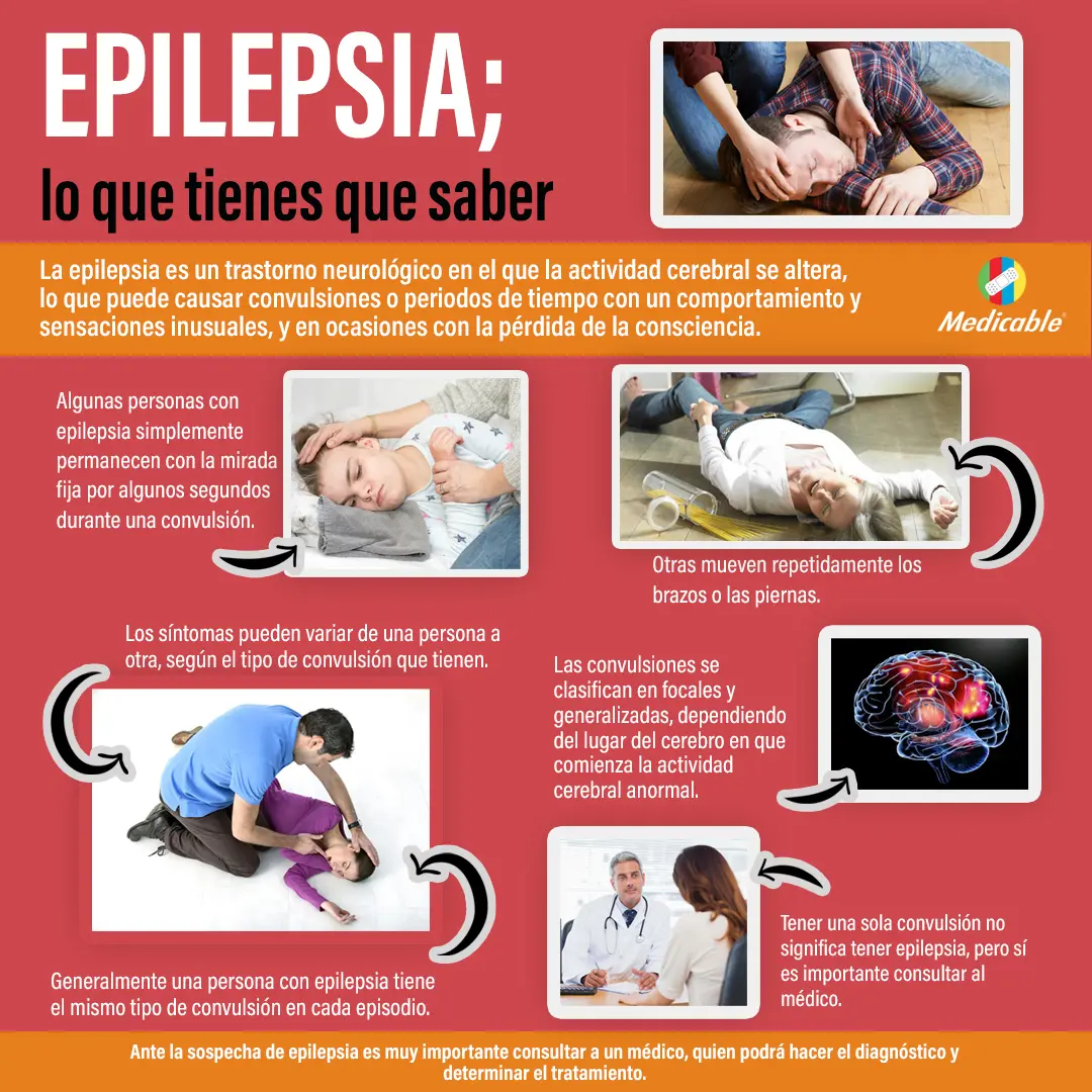Epilepsia, lo que tienes que saber