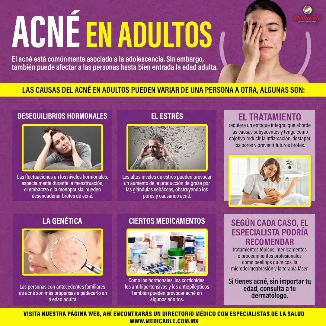 Acné en adultos
