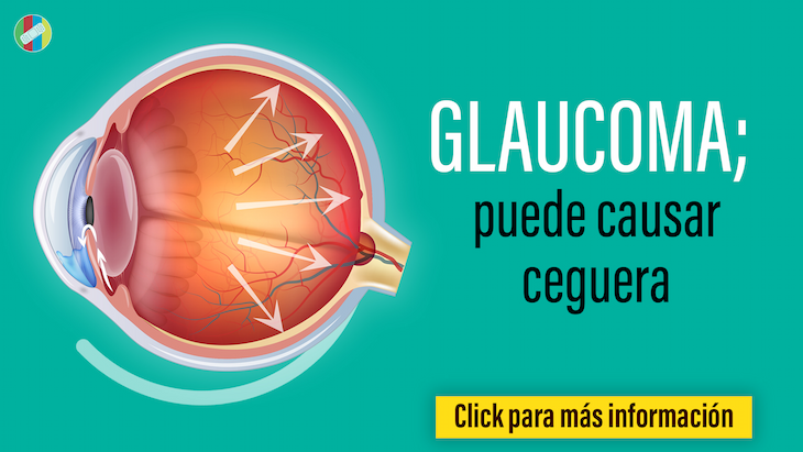 Glaucoma, puede causar ceguera