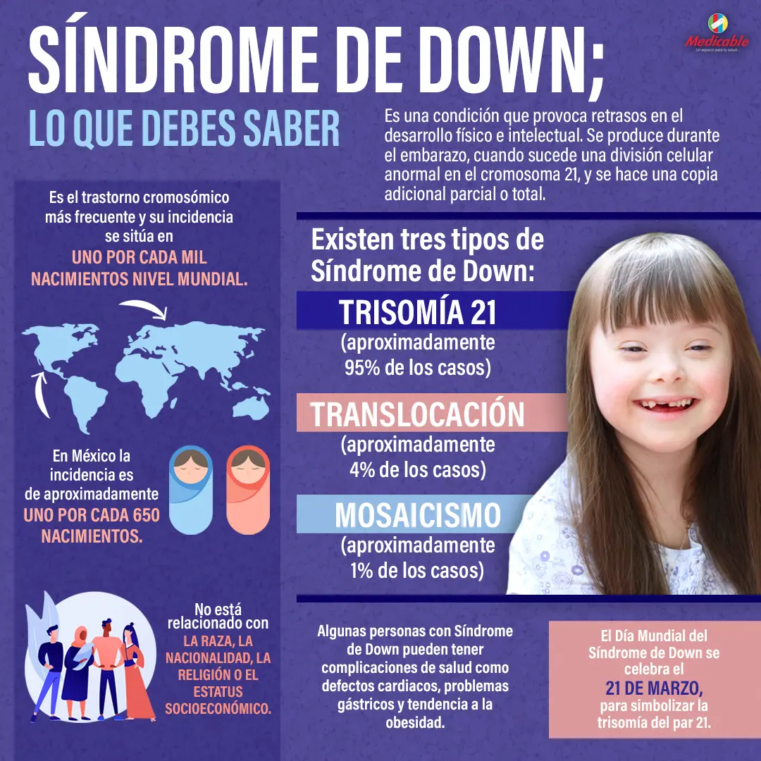 Síndrome de Down, lo que debes saber
