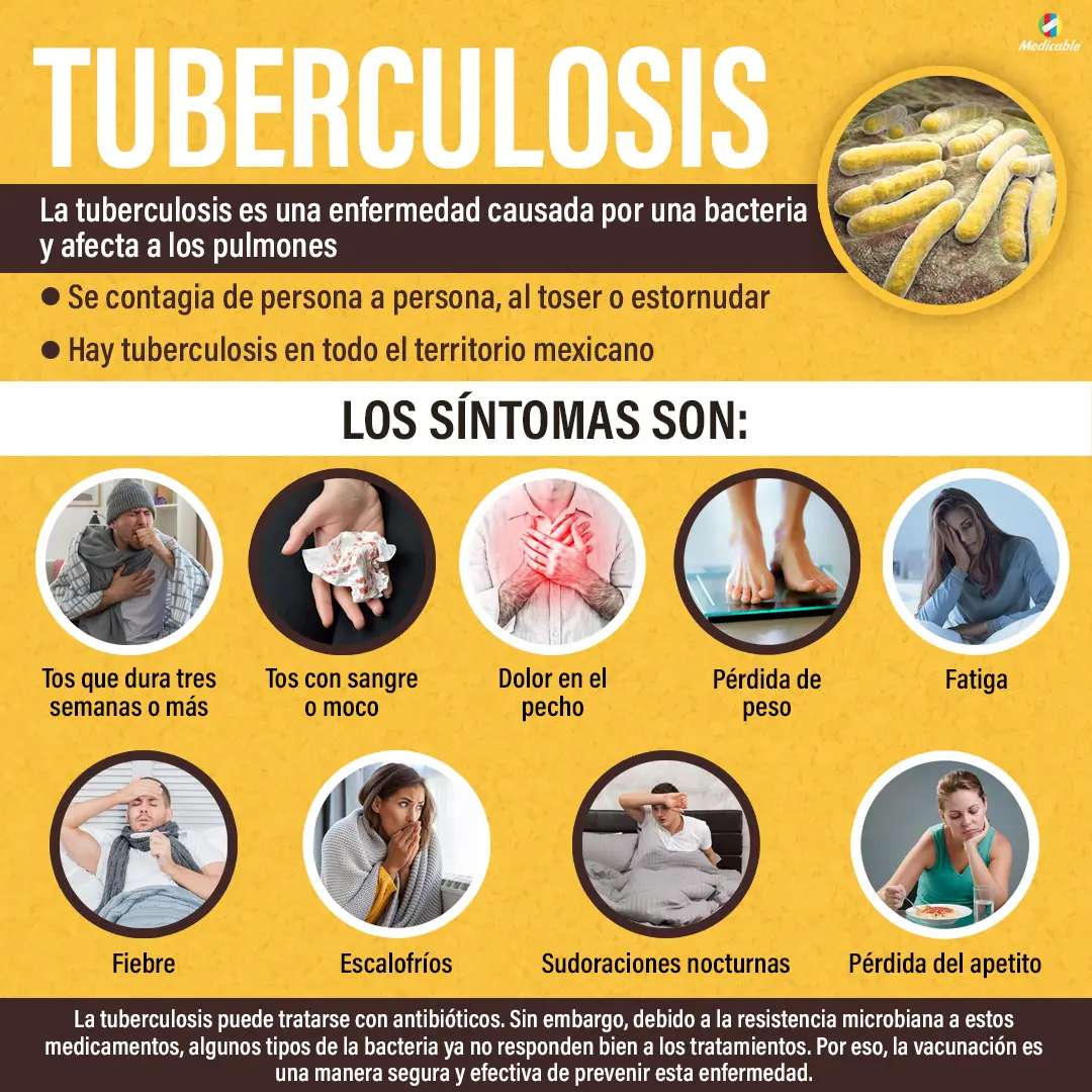 Tuberculosis, enfermedad que afecta los pulmones