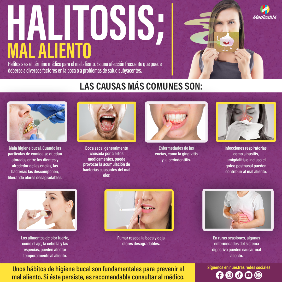 Halitosis; mal aliento.