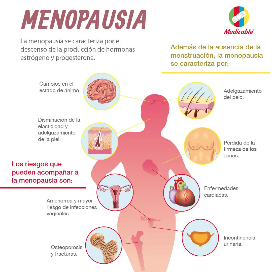 Menopausia