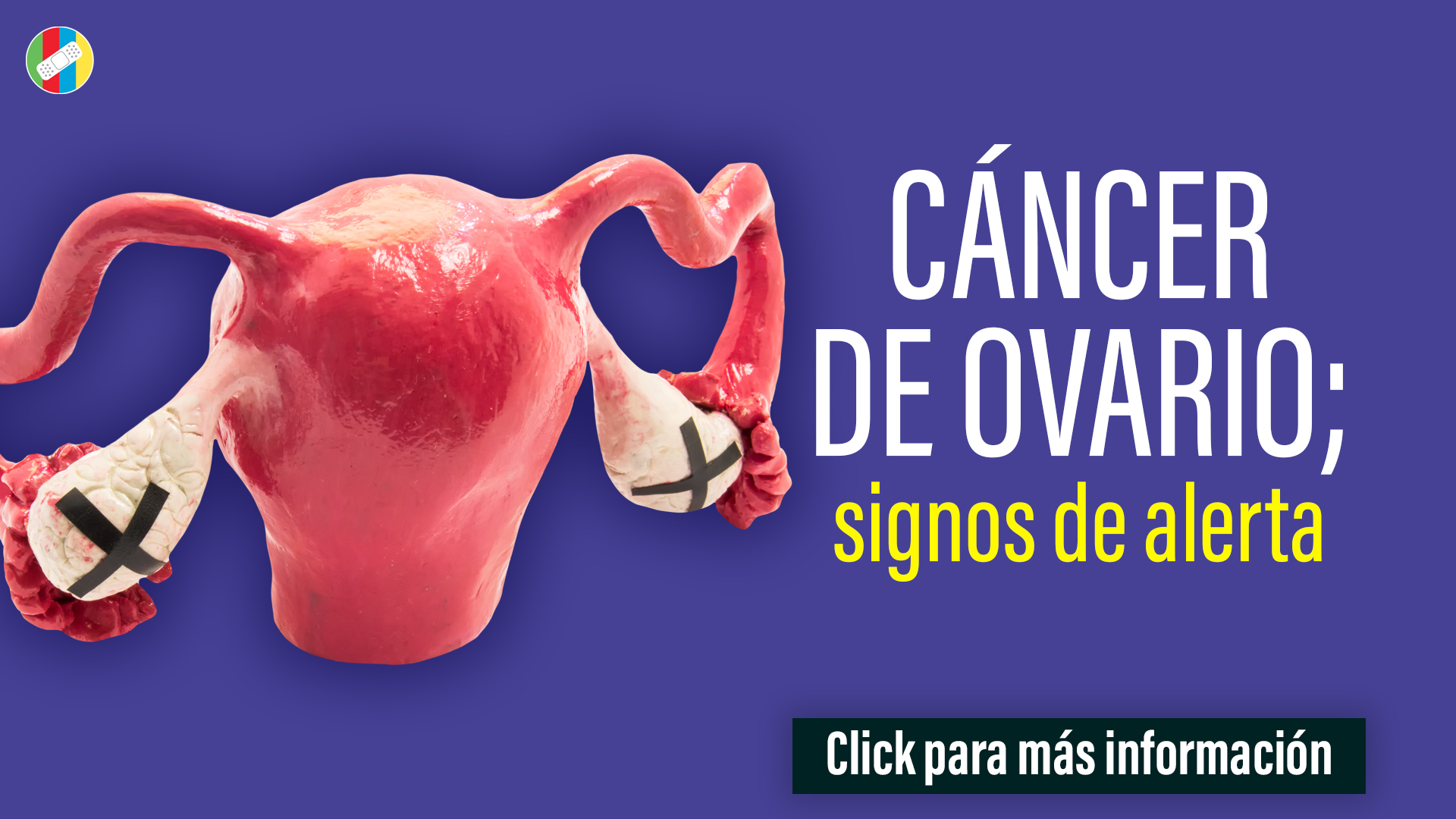 Cáncer de ovario.