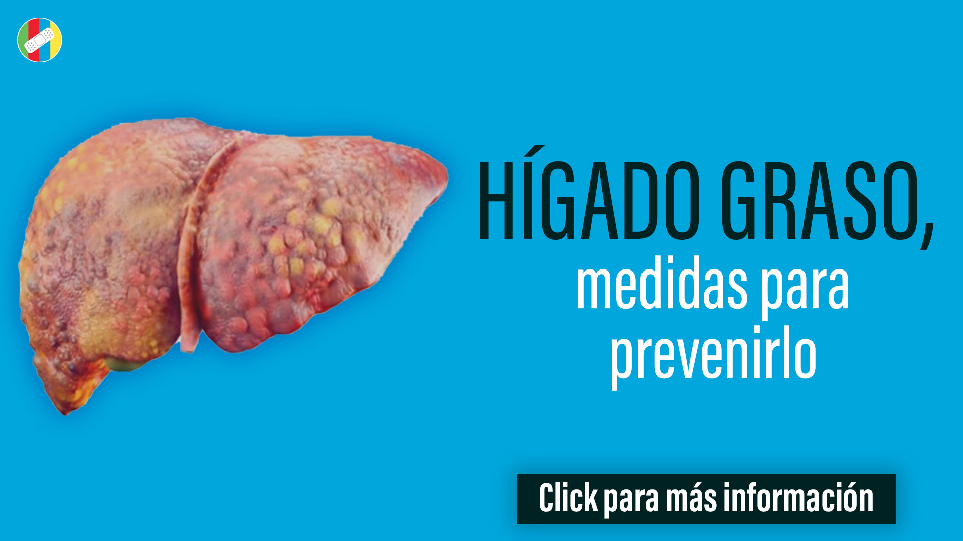 Hígado graso, medidas para prevenirlo.