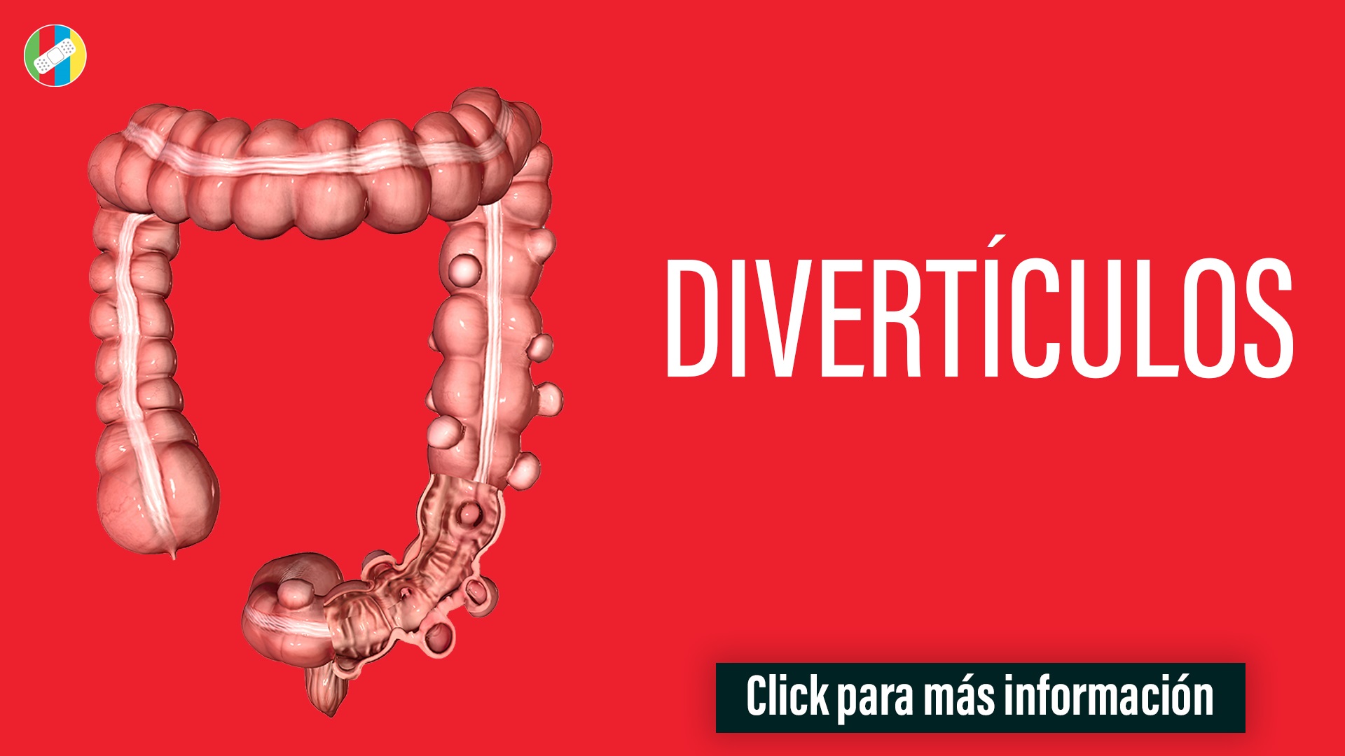 Divertículos