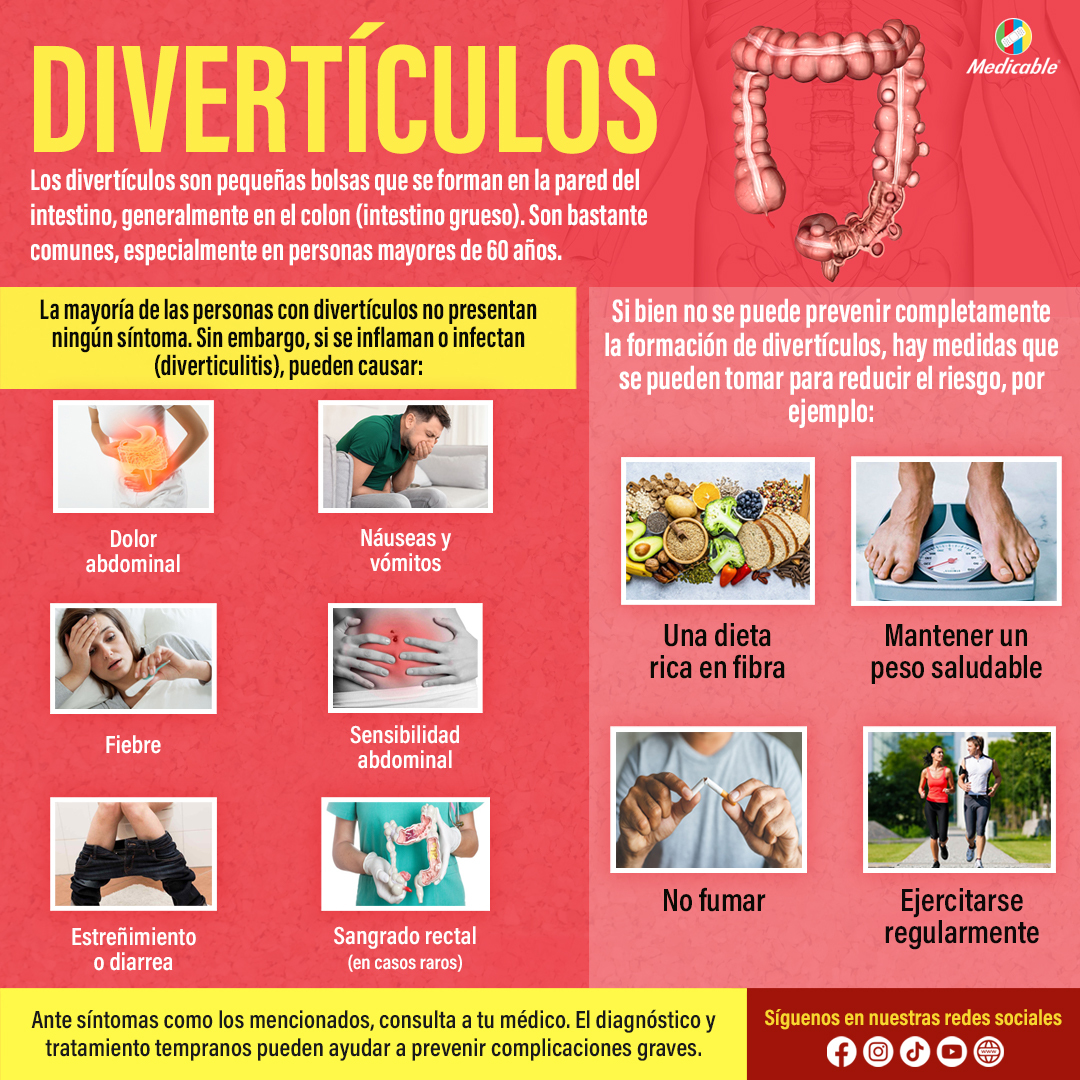 Divertículos