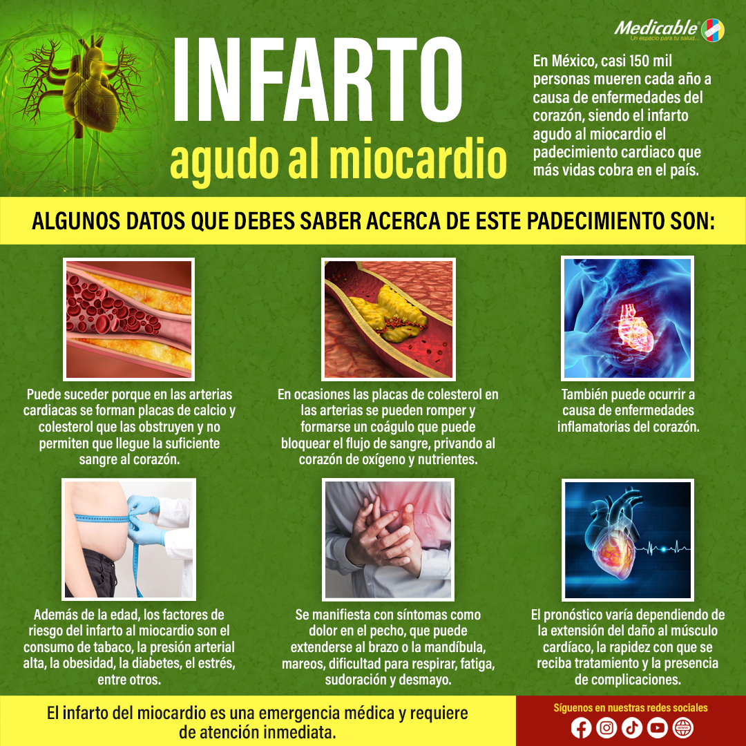Infarto agudo al miocardio