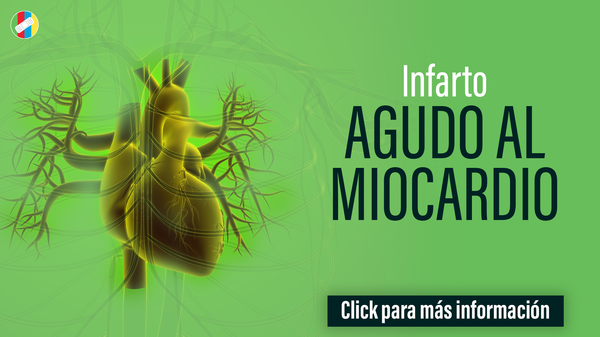 Infarto agudo al miocardio