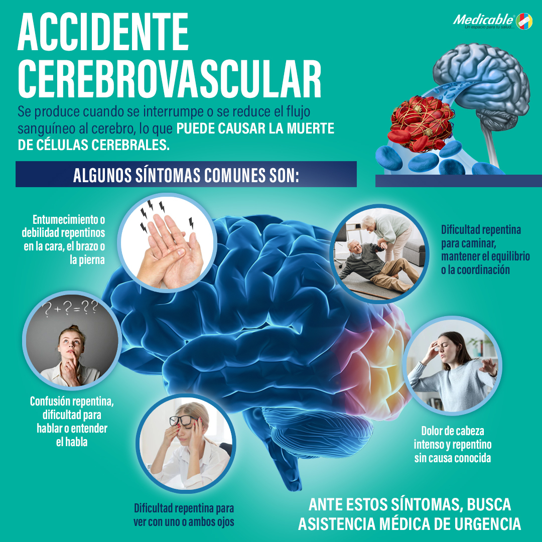 Accidente cerebrovascular.