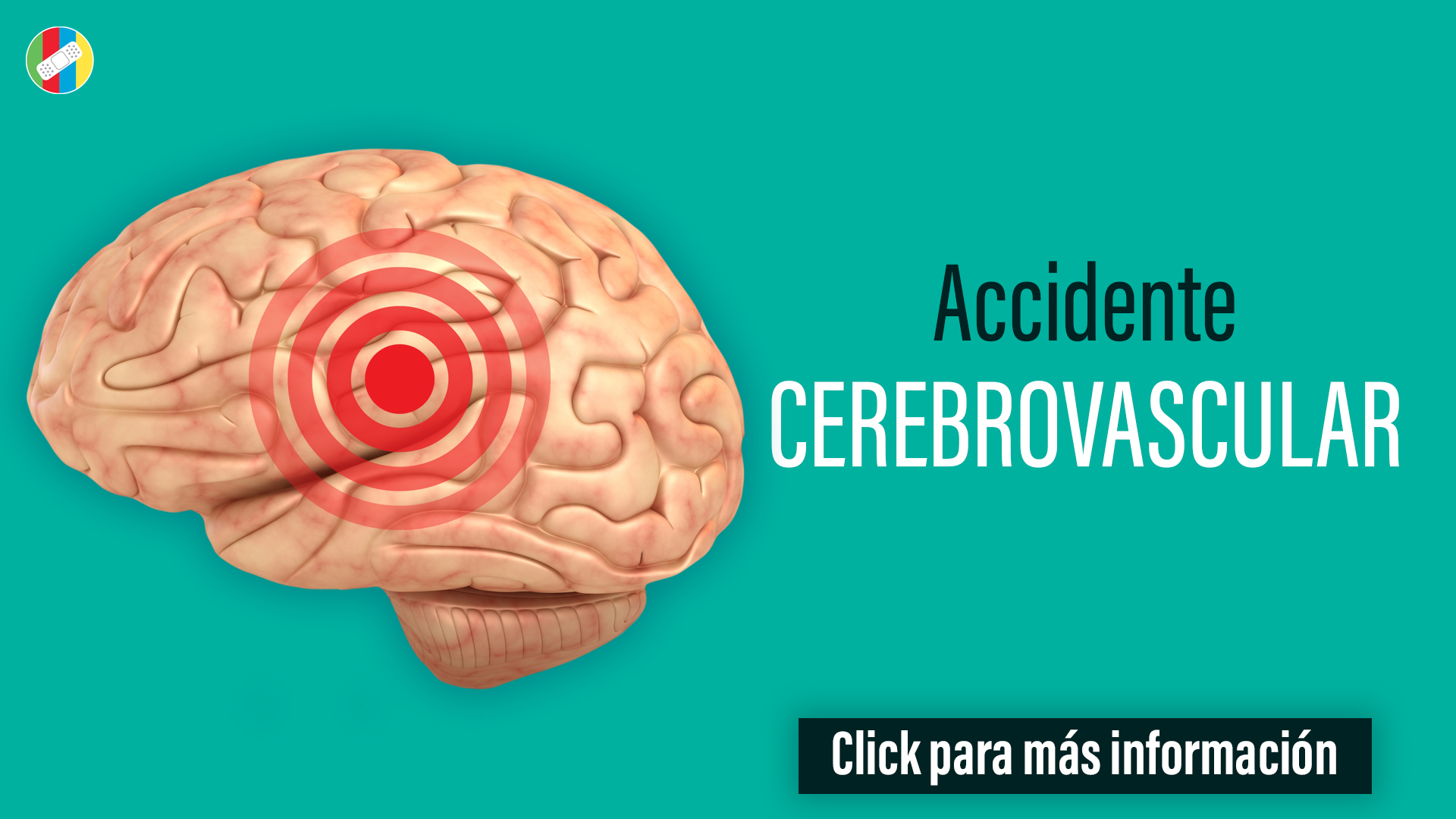 Accidente cerebrovascular.