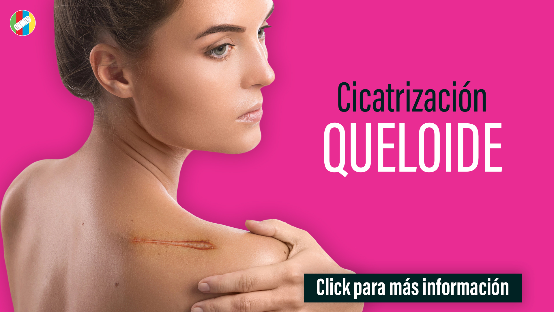 Cicatrización Queloide