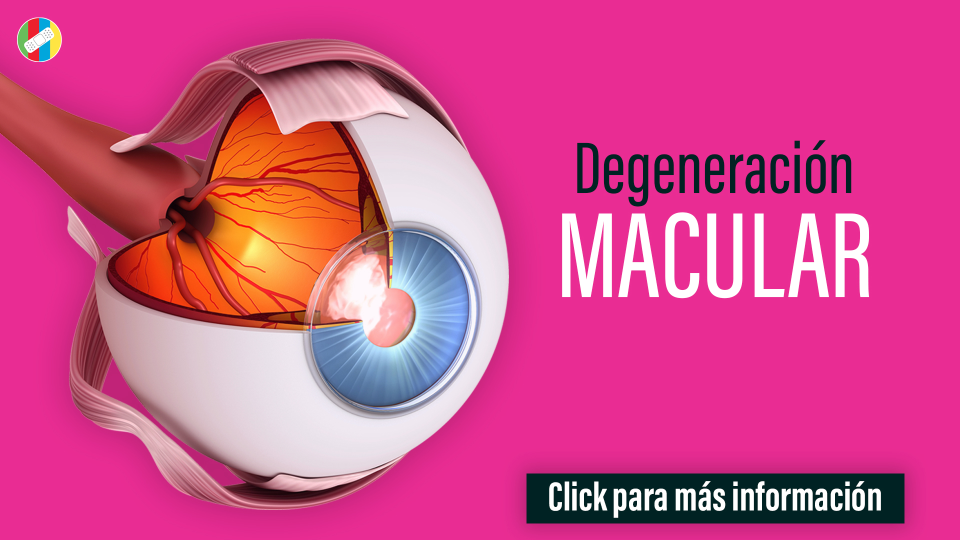 Degeneración Macular