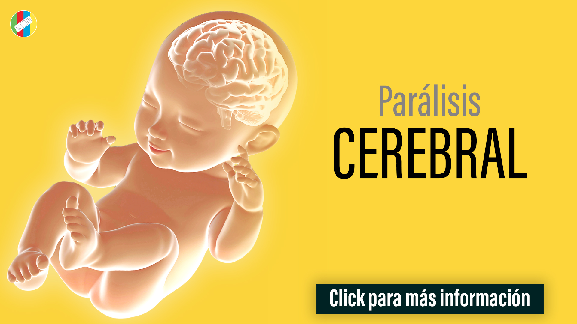 Parálisis Cerebral