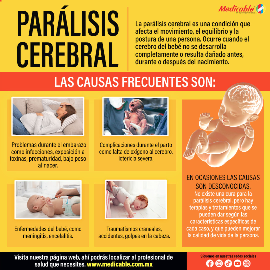 Parálisis Cerebral