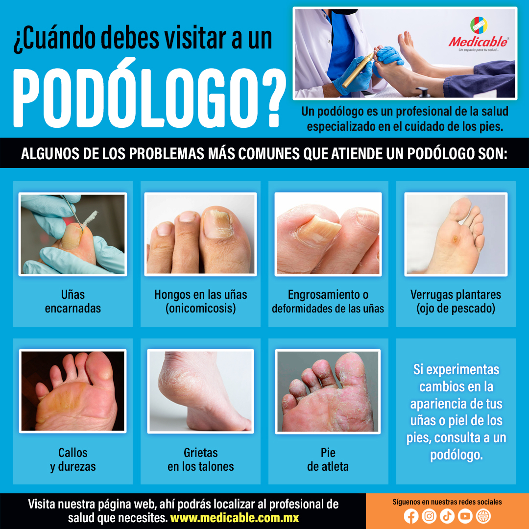 ¿Cuándo debes visitar a un podólogo?