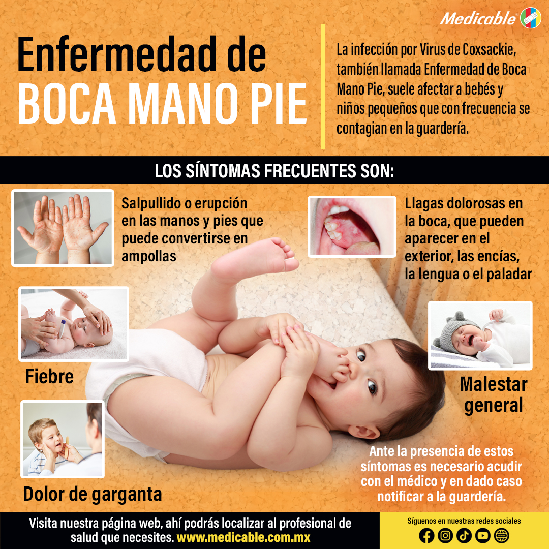 Enfermedad de Boca, Mano, Pie.