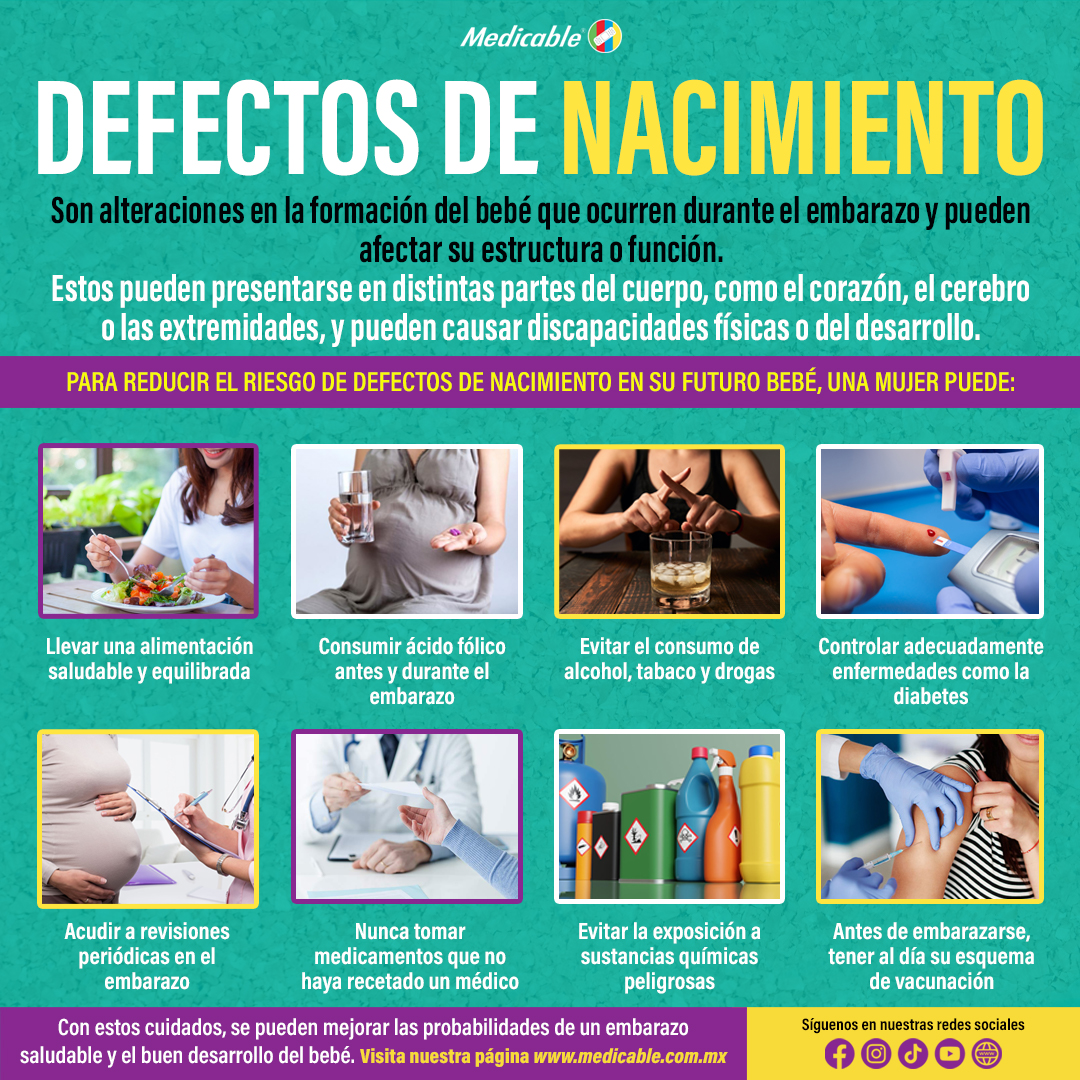 Defectos de nacimiento.