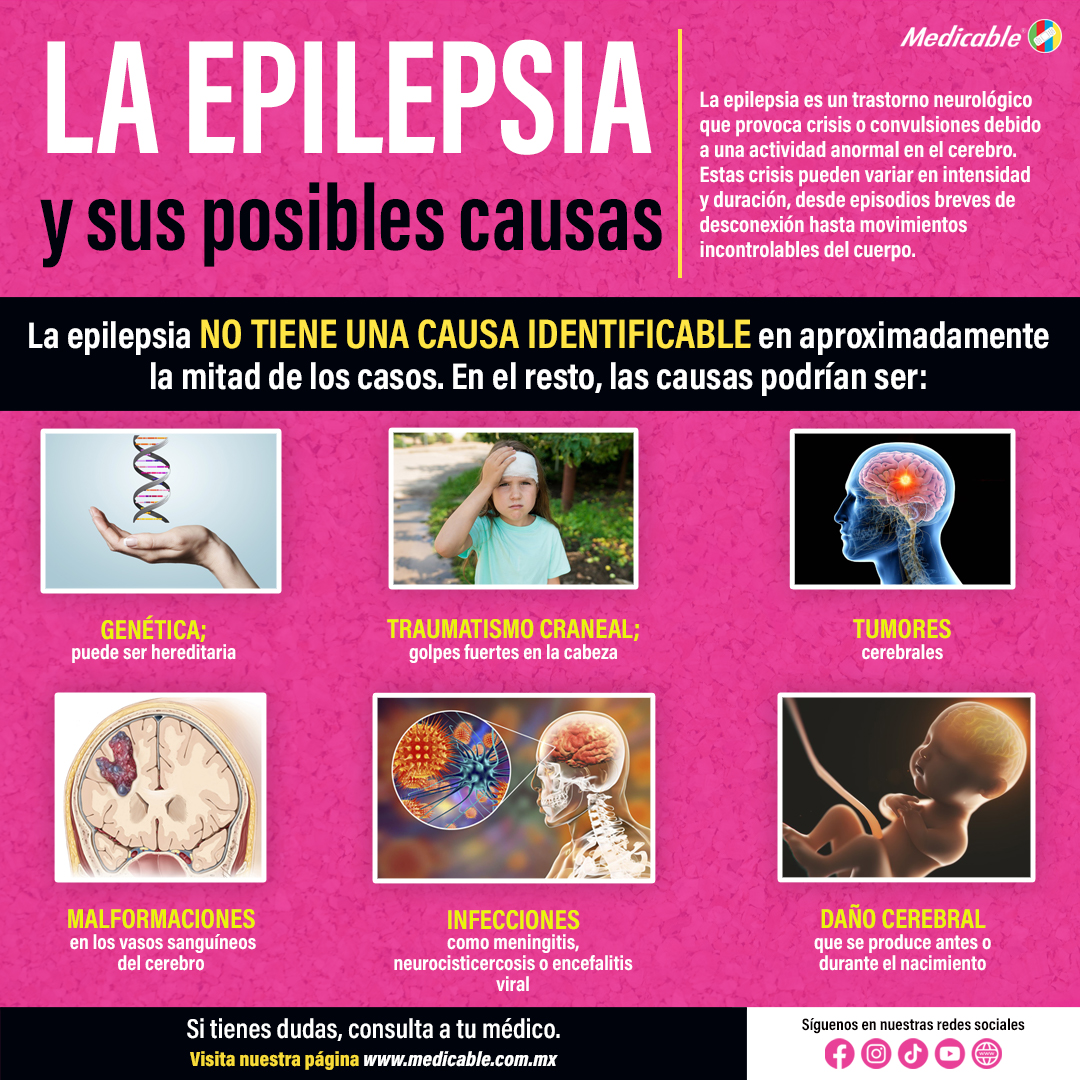 La Epilepsia y sus posibles causas.