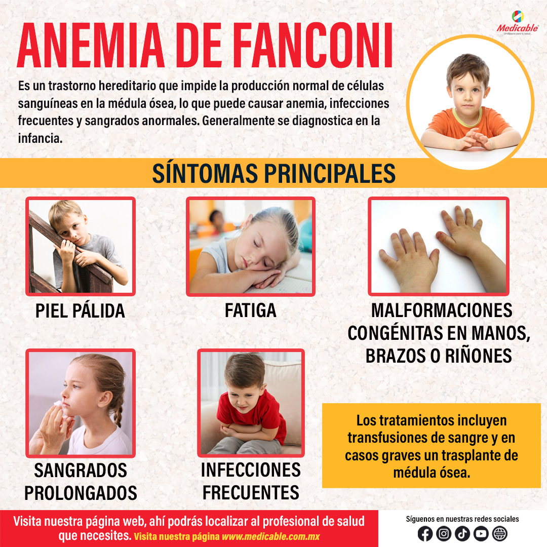 Anemia de Fanconi.