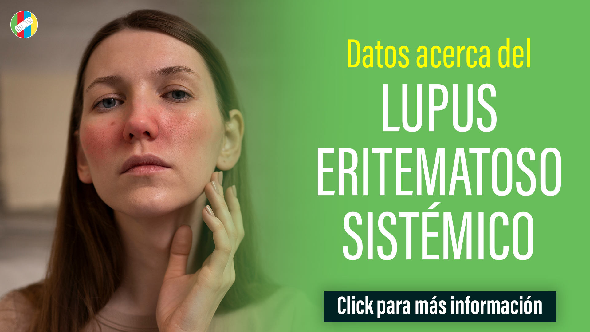 Datos acerca del Lupus Eritematoso Sistémico.
