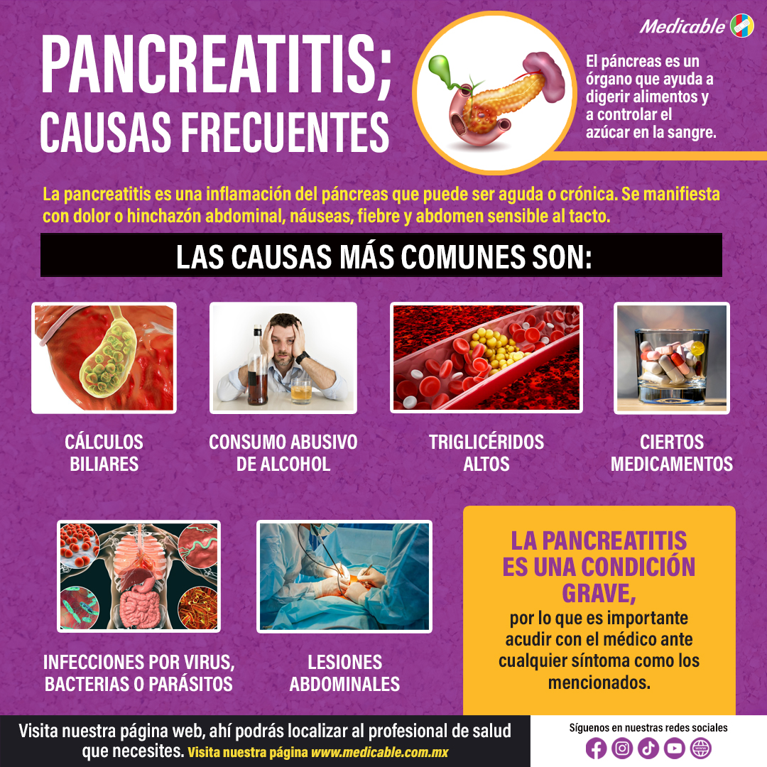 Pancreatitis, causas frecuentes.