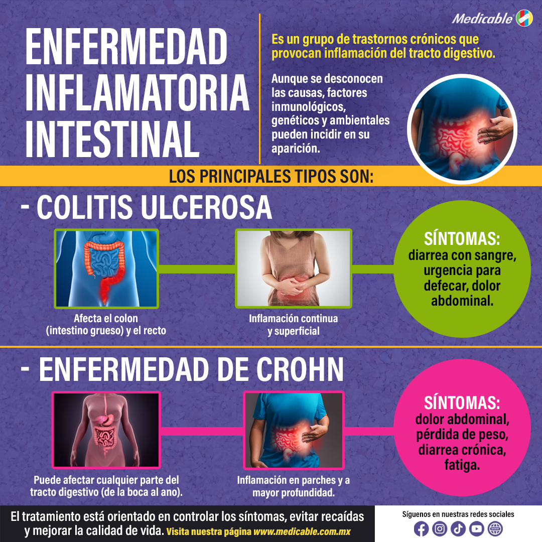 Enfermedad Inflamatoria Intestinal.