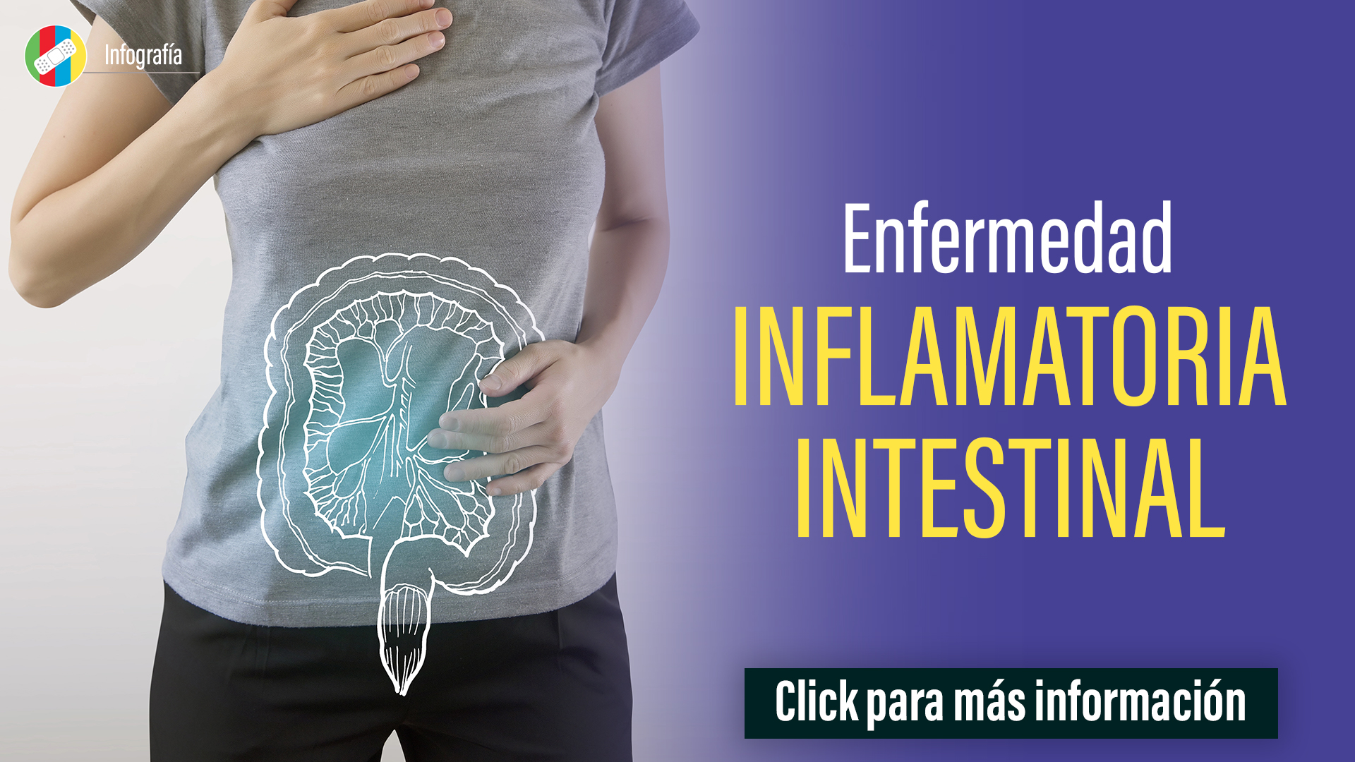 Enfermedad Inflamatoria Intestinal.