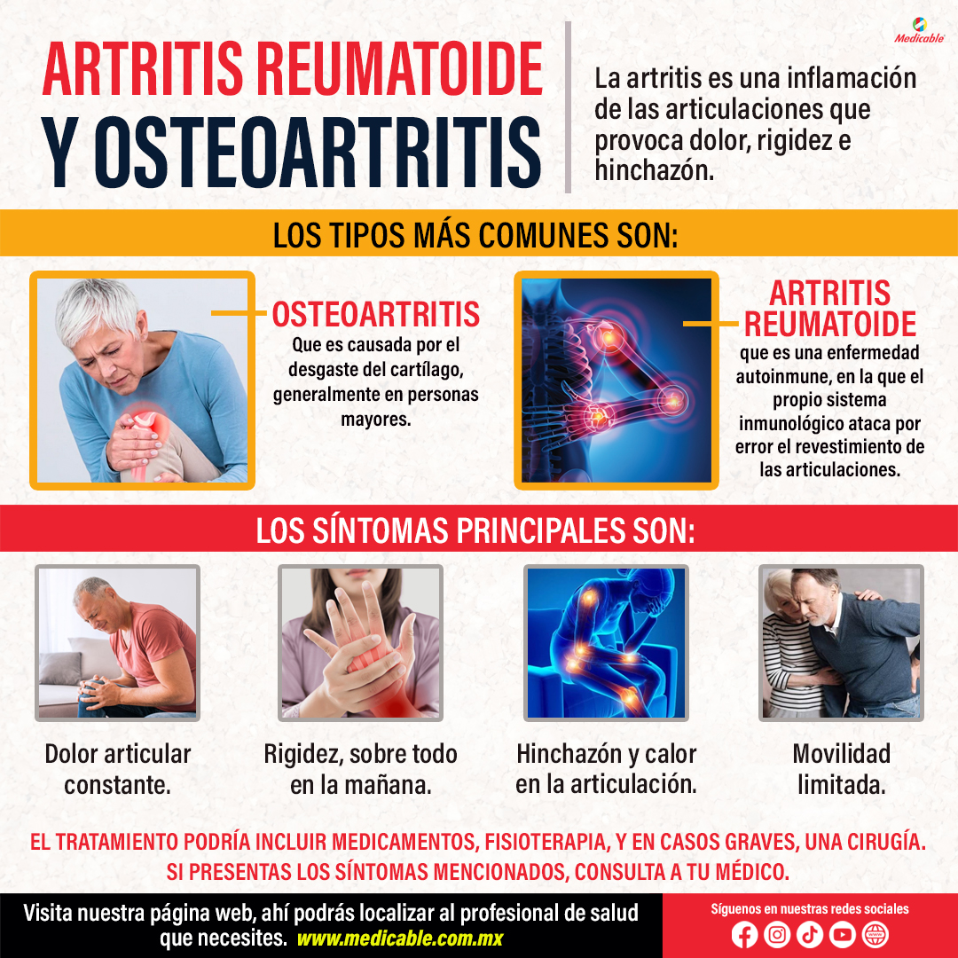 Artritis Reumatoide y Osteoartritis.
