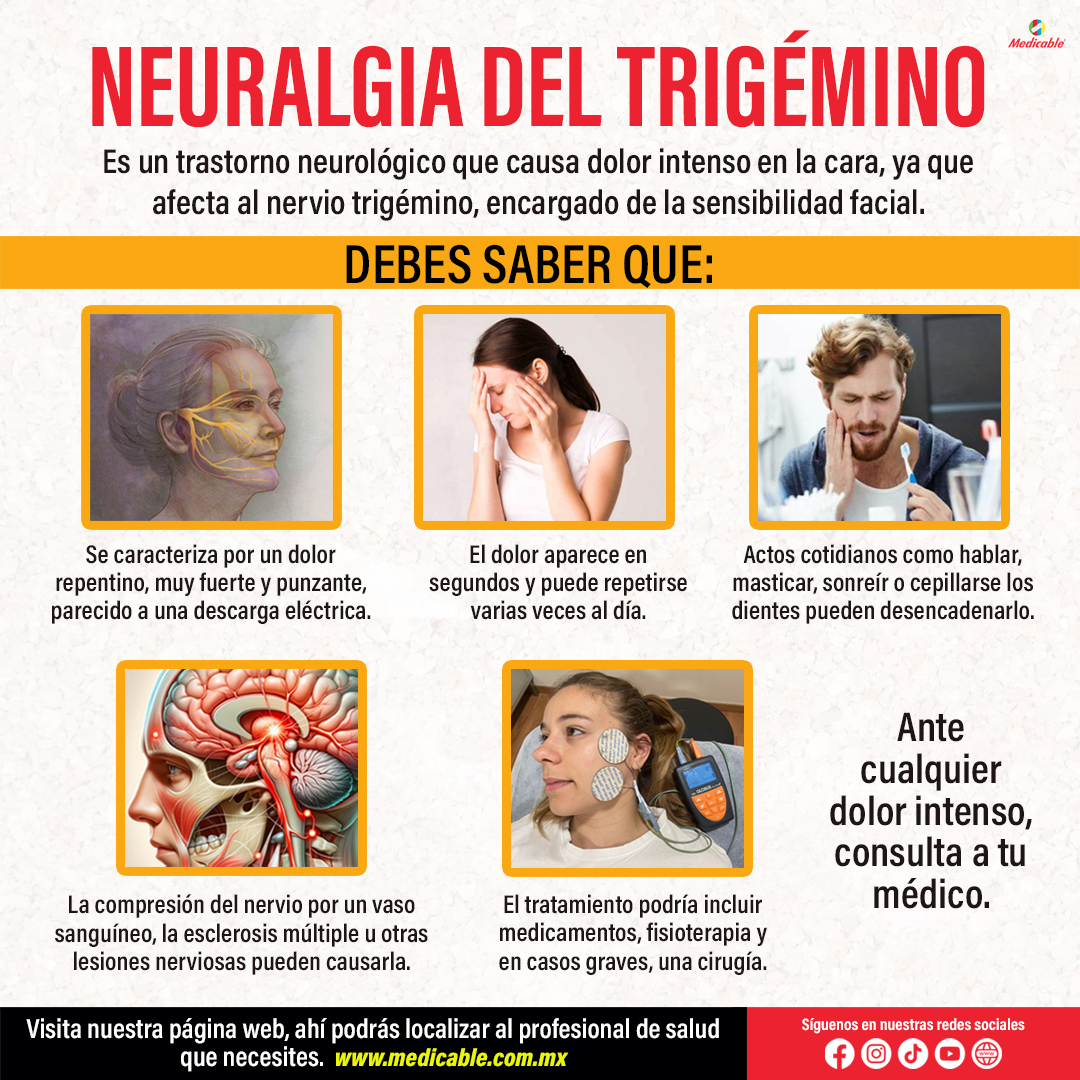 Neuralgia del trigémino.