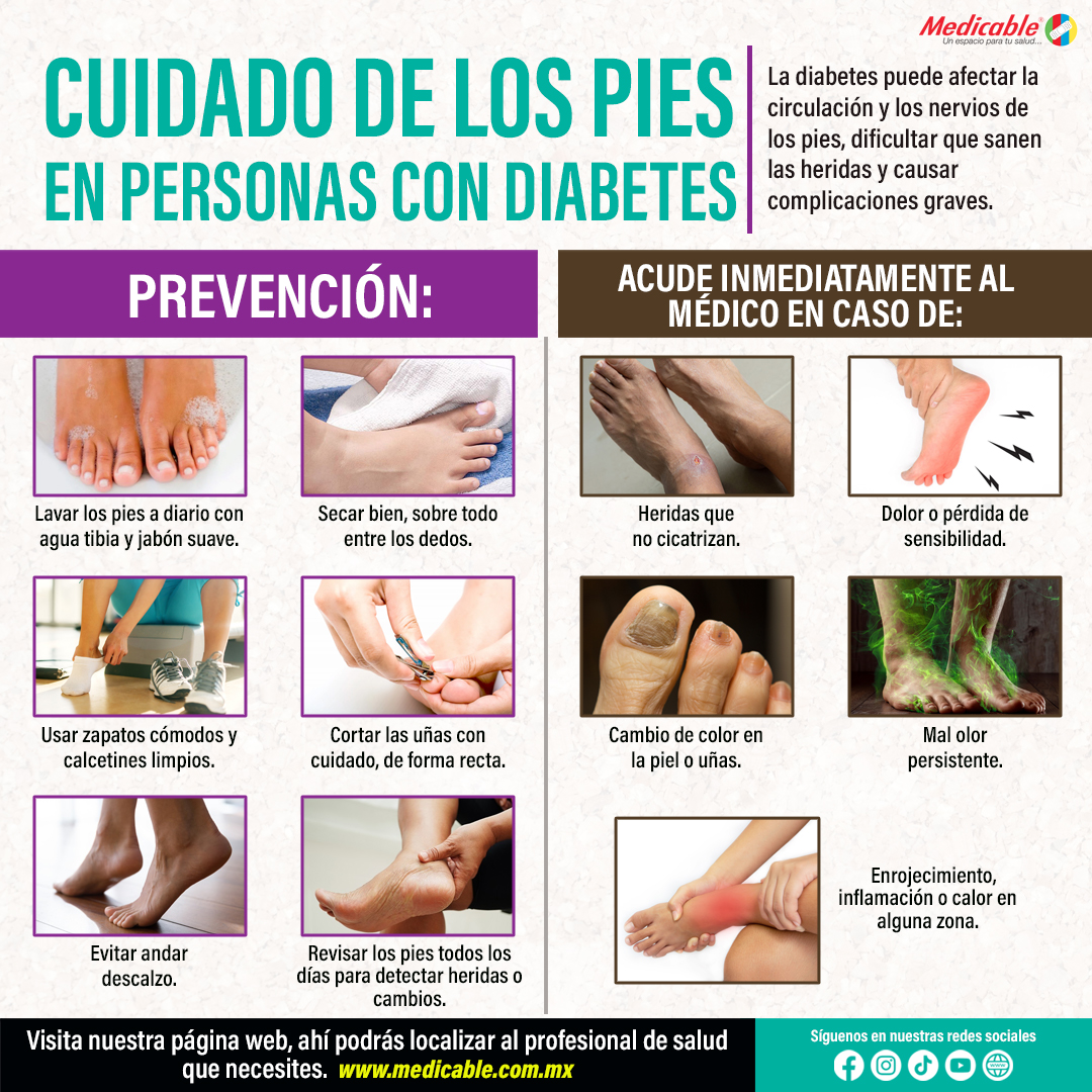Cuidado de los pies en personas con diabetes.