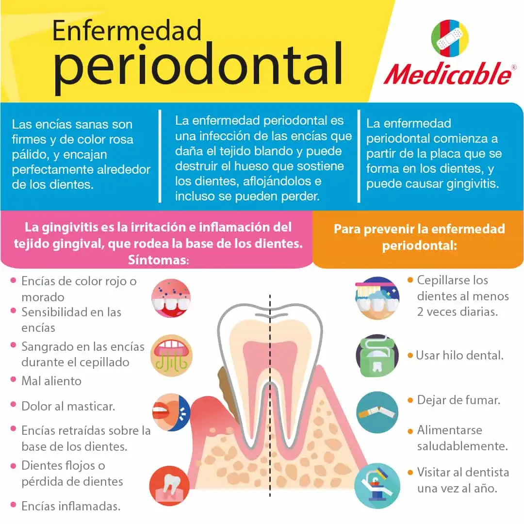 Enfermedad peridontal